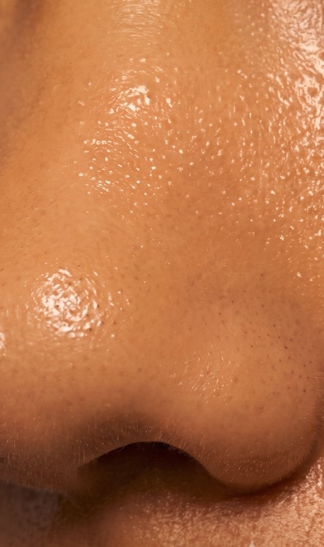 Clearer pores  — after